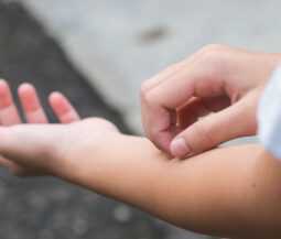 kid scratching his hand